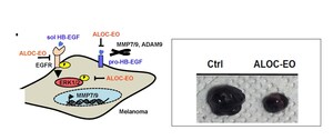 Juntendo University research: Aromatherapy in medicine: Essential oils prove to be effective against skin cancer