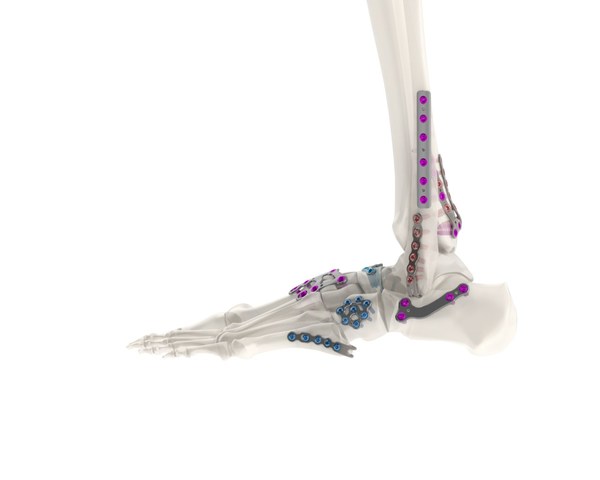 Unable to view the image, Please provide a valid URL.