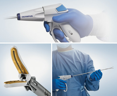 The POWERSEAL devices are best-in-class advanced bipolar energy solutions providing consistent and strong tissue sealing, as well as dissection and grasping capabilities. With an ergonomic design, the POWERSEAL devices reduce the force needed to close the jaws and reduce the reach distances to the jaw lever, cut trigger, and shaft rotation wheel.