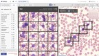 Scopio Labs Launches Full-Field Peripheral Blood Smear Application, Bringing End-to-End Digital Workflow to Hematology Labs to Transform Diagnostic Testing