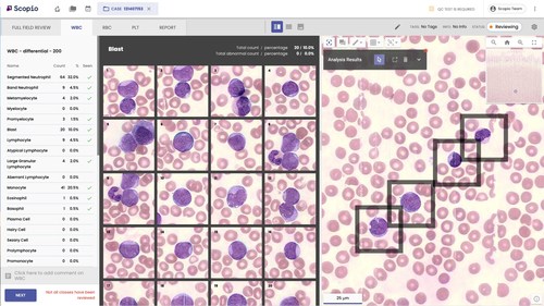 Image of Scopio's pioneering full-field digital imaging and deep cell morphology analysis of a Peripheral Blood Smear.