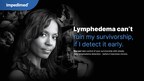 ImpediMed Launches "Lymphedema Can't" Educational Campaign for Breast Cancer Patients and Survivors