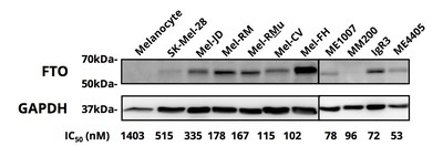 Figure 2. FTO protein expression determined by western blot.