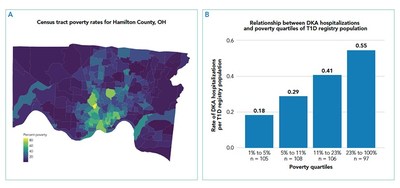 Poverty and Diabetes Complications: This map depicts poverty in Hamilton County, Ohio, by Census tract. The bar chart reports the number of diabetic ketoacidosis (DKA) hospitalizations per type 1 diabetes (T1D) registry population by poverty quartile.