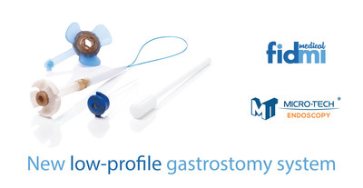 Fidmi Medical's new low-profile gastronomy system. (PRNewsfoto/Fidmi Medical Ltd.)