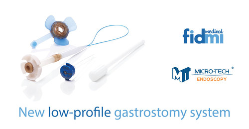 Fidmi Medical’s new low-profile gastronomy system. (PRNewsfoto/Fidmi Medical Ltd.)