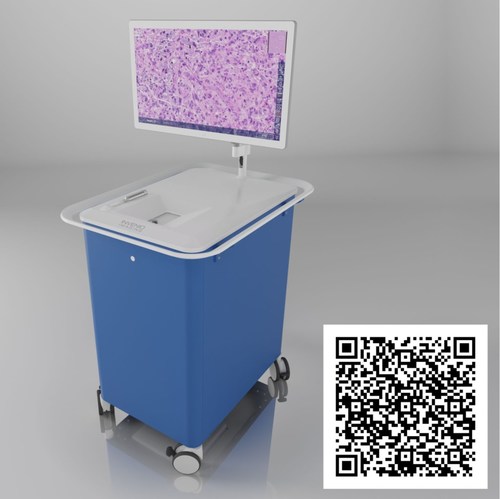 NIO Laser Imaging System