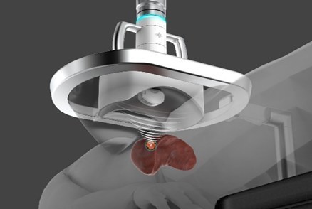 Figure 1: Rendering of HistoSonics treatment head demonstrating histotripsy delivery and targeted destruction of liver tissue.