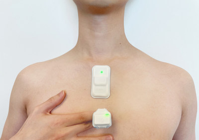 ANNE® One wearable dual-sensor system for adult vital sign monitoring.