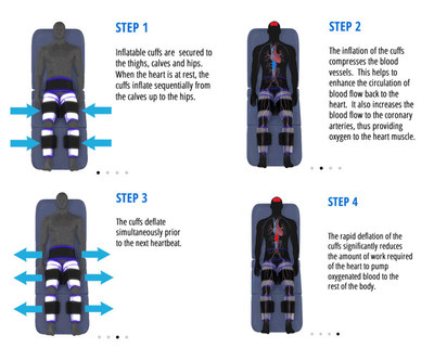 The four principle steps of the Cerezen device. Graphic courtesy of Renew Bioscience