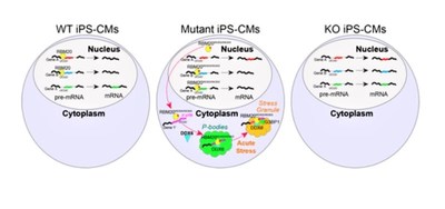 Model of mutant RBM20 differential splicing and P-body impacts in dilated cardiomyopathy.
Proposed model for the impact of wild-type and mutant RBM20 on nuclear regulation of splicing based on RNA-Seq and eCLIP data as compared to cytoplasmic role of mutant RBM20 on P-body formation and 3’UTR association with mRNAs implicated in granule formation.