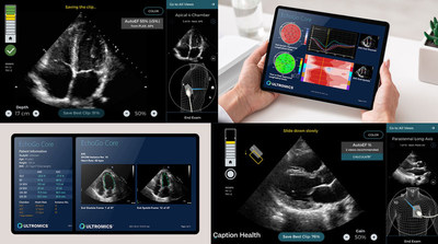 Caption AI platform and Ultromics EchoGo deep ultrasound analysis UIs, to be available together in the new year. Image via Caption Health/Ultromics