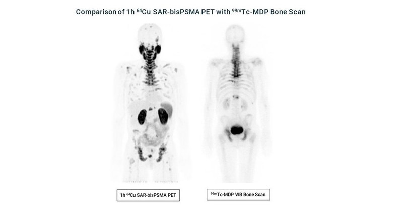 Clarity Pharmaceuticals - Radiopharmaceutical Therapies and Diagnostics