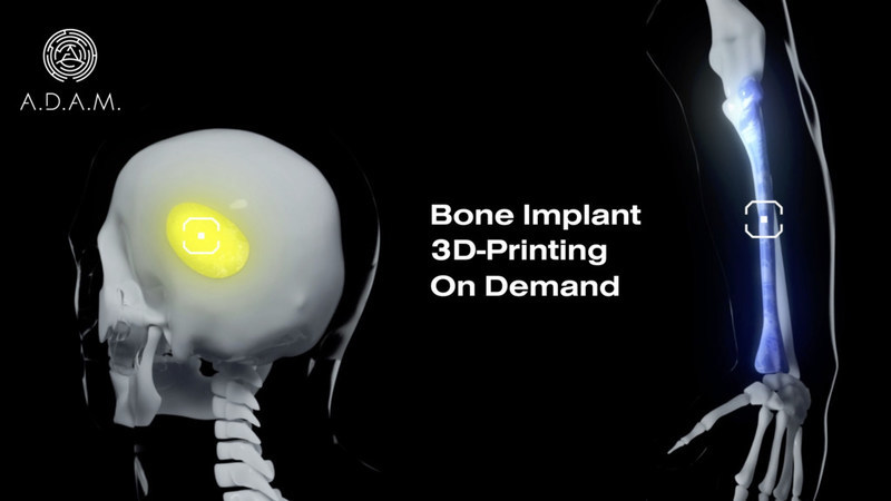 Nordamerika Shah Køre ud A.D.A.M., Developer of 3D-Bioprinting Platform, Launches Crowdfunding  Campaign