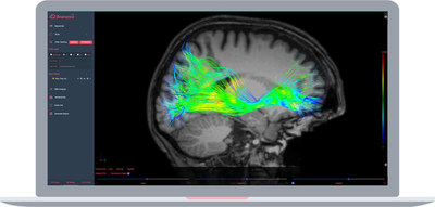 Advantis Medical Imaging secures FDA Clearance for its pure web-based and all-in-one neuroimaging platform