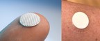 MyLife Technologies raises US$4.0 million to further develop its vaccine delivery technology through painless ceramic vaccine patches for 'Pandemic Preparedness'