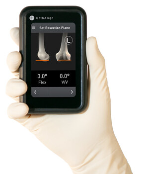 OrthAlign Announces the Launch of Lantern®: The Latest Handheld Smart Tool for Knee Replacement Surgery