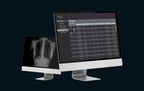 Lunit Gets FDA Nod for AI-based Chest X-ray Triage Solution, Developed for Sorting of Emergency Cases