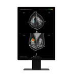 Lunit's AI Software for Breast Cancer Detection, Lunit INSIGHT MMG, Wins FDA Clearance