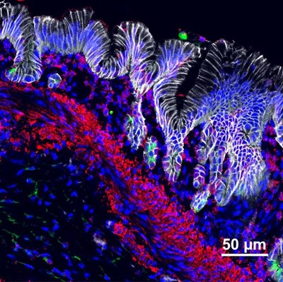 This confocal image shows a three-layered human stomach organoid growing in a mouse at 14 weeks after it was started in a lab at Cincinnati Children's. A study in Cell Stem Cell details how the most complex stomach organoid to date was made.