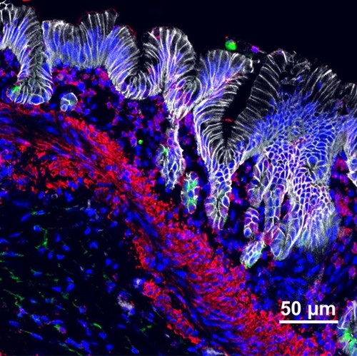 New Assembly Approach Generates Most Complex Stomach Organoids To Date