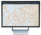 Roche announces the release of its newest artificial intelligence based digital pathology algorithms to aid pathologists in evaluation of breast cancer markers, Ki-67, ER and PR
