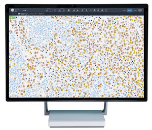 Roche announces the release of its newest artificial intelligence based digital pathology algorithms to aid pathologists in evaluation of breast cancer markers, Ki-67, ER and PR