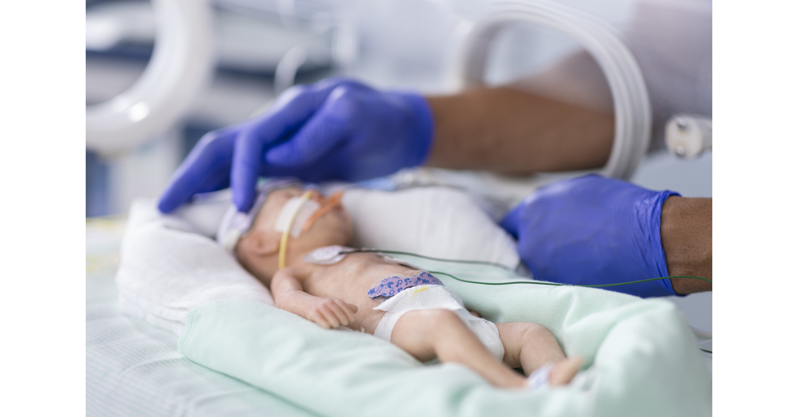 Medtronic Invos™ 7100 Cerebralsomatic Oximetry System Receives 510k Clearance For Pediatric 8165