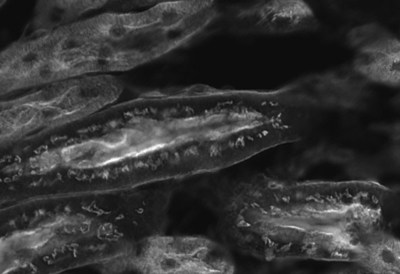 Comparison of fluorescent images (monochrome) of mouse kidney
Images were acquired with the conventional mode "Digital Sight 10"