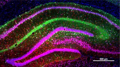 Newly converted neurons (green) near hippocampal CA1 region of TLE rats are mainly inhibitory interneurons (PV, SST)