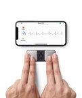 Il NICE raccomanda il primo ECG basato su smartphone per il rilevamento della fibrillazione atriale (FA) per persone con sospetta FA parossistica tramite un monitoraggio qualità ambulatoriale