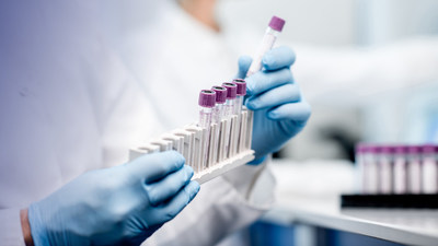 Nashville Biosciences’ enriched biobank data, coupled with Illumina’s extensive genomics and bioinformatics expertise, will enable scientists and researchers to generate new insights into disease and develop new medicines