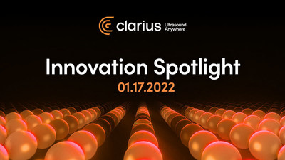Clarius will be streaming its 2022 Innovation Spotlight on Monday, January 17 at 4PM Pacific / 7PM Eastern where it will unveil a new line of miniaturized smartphone ultrasound scanners. Registration for the event is now open for this complimentary virtual event.
