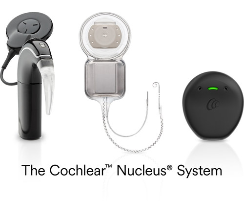 FDA approves those with unilateral hearing loss (UHL)/single-sided deafness (SSD) can now seek treatment with a cochlear implant from Cochlear to hear with both ears.