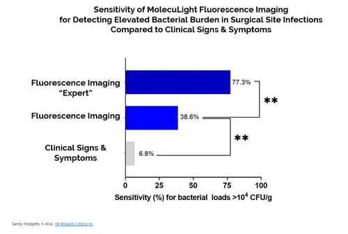 Sensitivity of MolecuLight Fluorescence Imaging for Detecting Elevated Bacterial Burden in Surgical Site Infections Compared to Clinical Signs & Symptoms (CNW Group/MolecuLight)