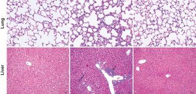 These microscope images of mouse lung tissue (top) and liver tissue (bottom) compare immune cell infiltration between healthy control mice (left), untreated mice experiencing auto-immune cytokine storm (middle) and mice receiving antibody treatment to block T cell-induced activation of inflammatory cytokines. Arrows indicate periportal and lobular infiltrates in the liver.