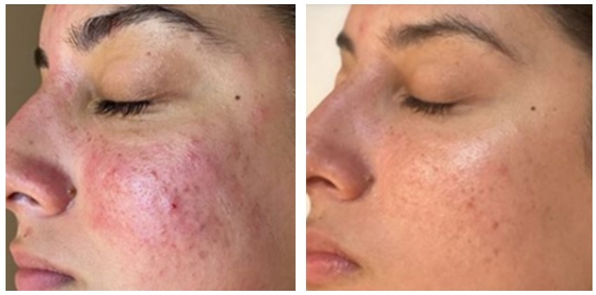 Unable to view the image, Please provide a valid URL.