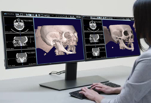 This image depicts IMS CloudVue's standard 3D & cinematic 3D. IMS believes it is democratizing the market by providing a cost-effective solution for clinicians who wish to utilize mobile cinematic rendered images. By improving the realism of the images, it improves the perception of the anatomy by the clinician and enables more accurate diagnoses and better outcomes for patients.