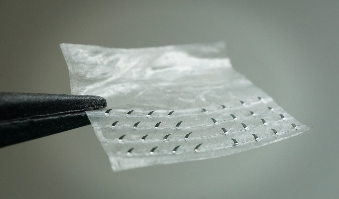 Smithfield BioScience, BioCircuit Technologies to Deliver Innovative Nerve Repair Solution - Vimarsana News