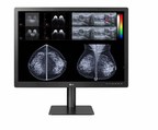 LG Business Solutions apresenta monitor de diagnóstico otimizado para mamografia e tomossíntese