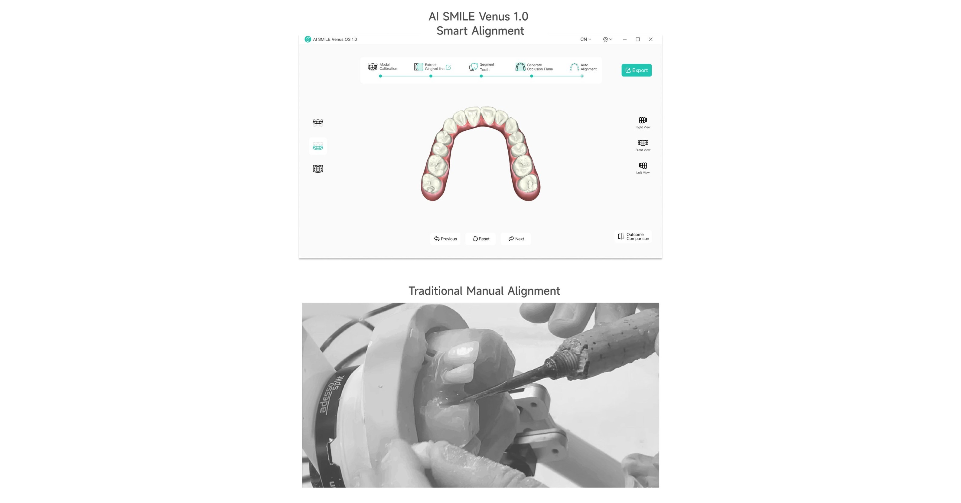 Medical Revolution: AI Firm WEIYUN AI & Robotics Group Launches Orthodontic Smart Alignment System Venus 1.0