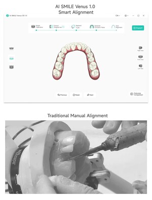 Medical Revolution: AI Firm WEIYUN AI &amp; Robotics Group Launches Orthodontic Smart Alignment System Venus 1.0
