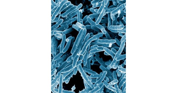 Texas Biomed selected as premier national tuberculosis research center