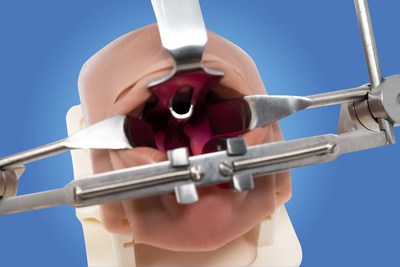 Simulare Medical, a Division of Smile Train Launches First Bilateral Cleft Lip and Palate Simulator