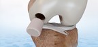 FDA approves CartiHeal's Implant for the Treatment of Cartilage and Osteochondral Defects