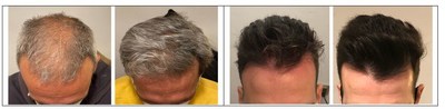 Dr. Iñigo de Felipes clinical results images (before/left and after/right)
