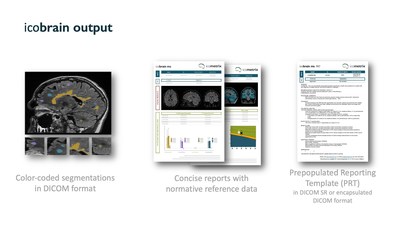 icobrain output includes color-coded segmentations in DICOM format, concise reports with normative reference data, and prepopulated reporting templates.