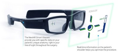 NextAR use of Vuzix Blade smart glasses - Image courtesy of Medacta