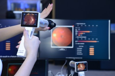 Portable Edge AI-DR can locate four main lesions and classify five severity levels of diabetic retinopathy.​