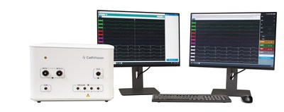 The ECGenius System is an innovative electrophysiology (EP) recording system designed to guide and enhance ablation therapy through the acquisition of low-noise, high-fidelity EP signals.